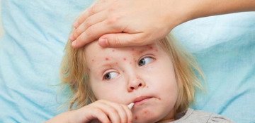 WHO warns of sharp rise in measles in Europe with 41,000 cases, 37 deaths