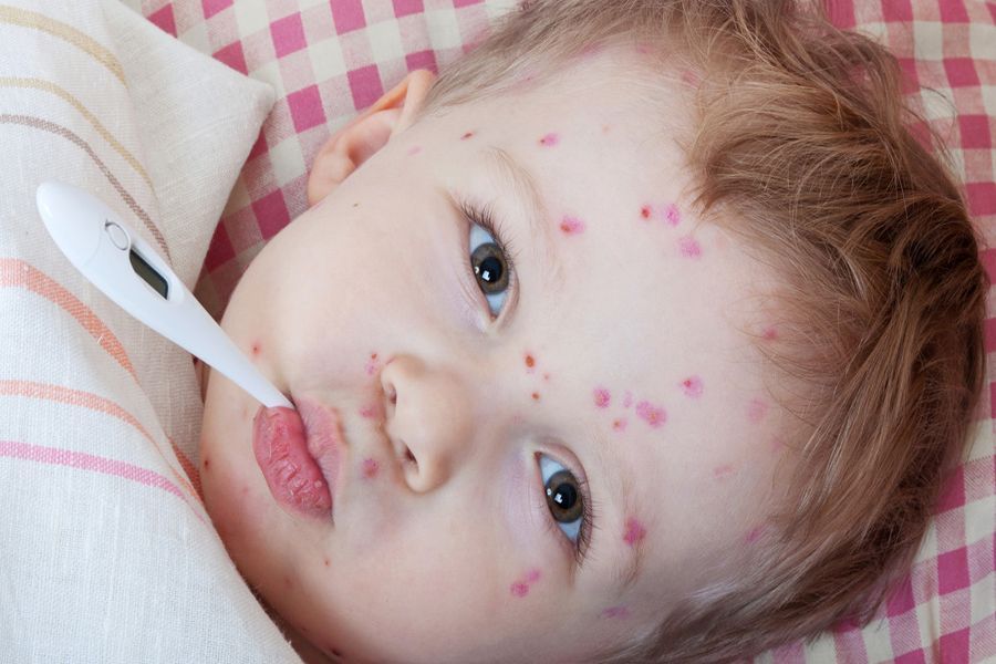 2385 people infected with measles in Georgia