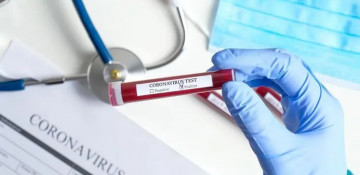 Two more Azerbaijani citizens who arrived from abroad infected with coronavirus