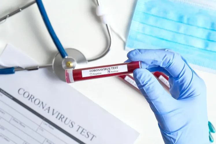 Two more Azerbaijani citizens who arrived from abroad infected with coronavirus