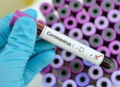 110 coronavirus cases in Armenia