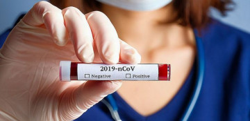 6 new cases of coronavirus recorded in Azerbaijan, one of them died