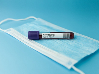 First case of coronavirus death reported in Armenia