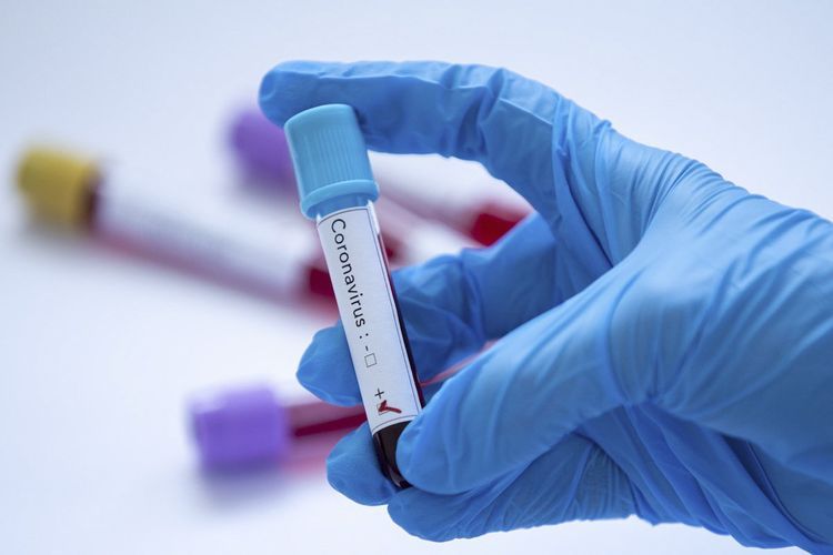Task force: 43 more infected with coronavirus in Azerbaijan