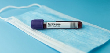 3 die in Armenia of COVID and 482 infected