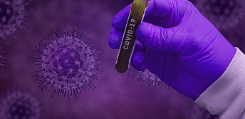 571 confirmed cases of infection with coronavirus in Armenia