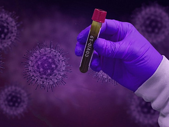 571 confirmed cases of infection with coronavirus in Armenia