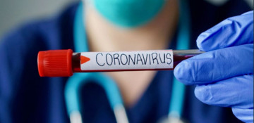 Six police officers test positive for coronavirus in Armenia