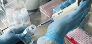 Azerbaijan among world leaders in number of coronavirus tests