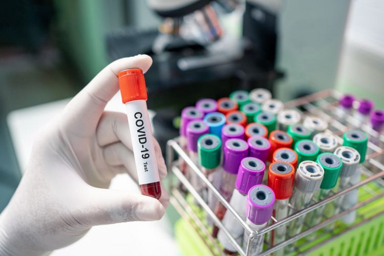 Netherlands's total death toll from coronavirus reaches 2,248