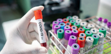 Azerbaijan records 50 new coronavirus cases; 1 dies and 39 recover 