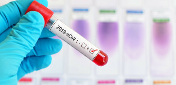 Azerbaijani researchers develop transmission dynamics of COVID-19