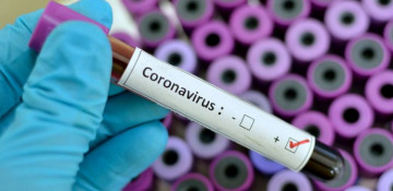 COVID-19 cases in Georgia reach 566