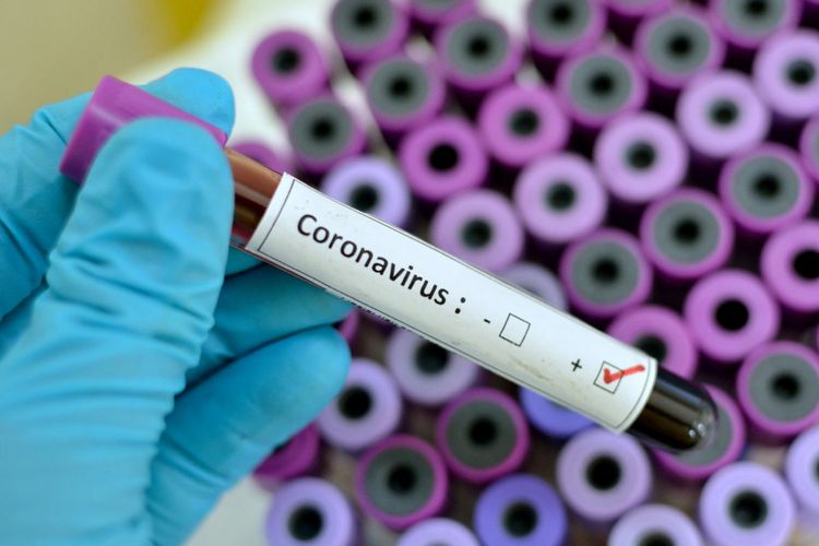 COVID-19 cases in Georgia reach 566