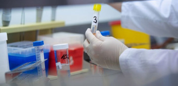 Azerbaijan discloses number of coronavirus tests