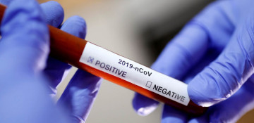 Azerbaijan confirms 168 new coronavirus cases, 80 recoveries, 5 deaths