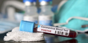 Azerbaijan: Number of coronavirus tests passes 328,000