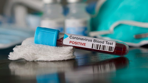 About 100 police officers are infected with coronavirus in Armenia