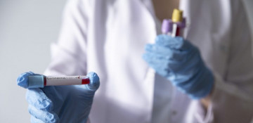 Azerbaijan records 339 fresh COVID-19 cases