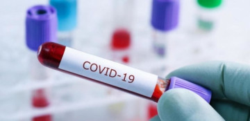 551 new COVID-19 cases reported in Armenia, 16 new deaths