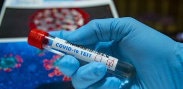 Azerbaijan confirms 548 new coronavirus cases