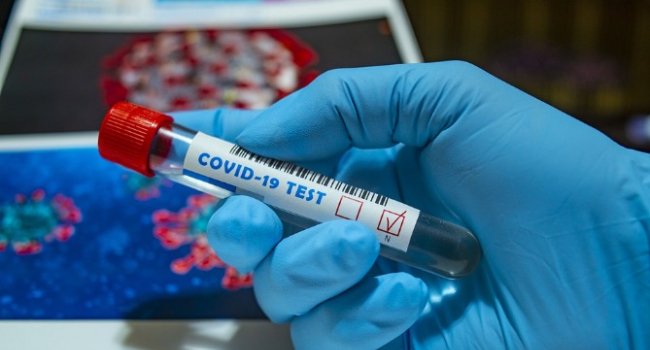 Azerbaijan confirms 548 new coronavirus cases