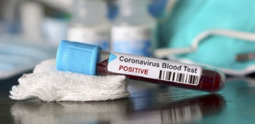 COVID-19 cases in Armenia exceed 35 thousand