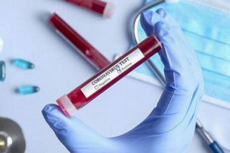 TABIB: No shortage of coronavirus tests in Azerbaijan