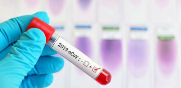 Azerbaijan records fall in new daily COVID-19 cases