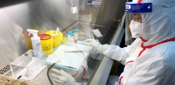 Mortality among COVID-infected people in Azerbaijan lower than in other countries - infectiologist