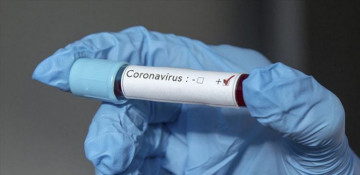 Coronavirus cases in occupied Nagorno-Karabakh reach 281