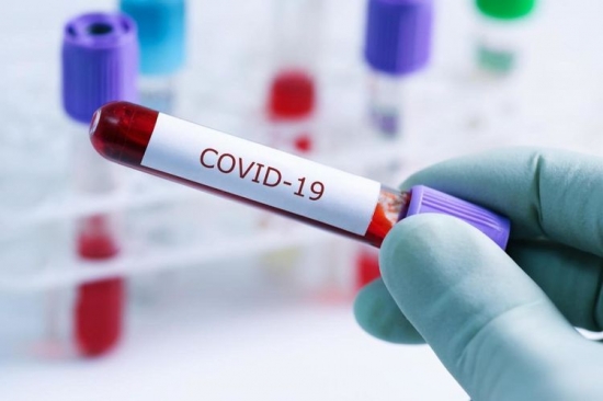 Azerbaijan confirms 167 new coronavirus cases