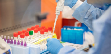 COVID-19 cases in occupied Azerbaijani territories rise to 304