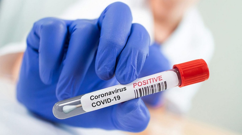 Azerbaijan confirms 139 new coronavirus cases