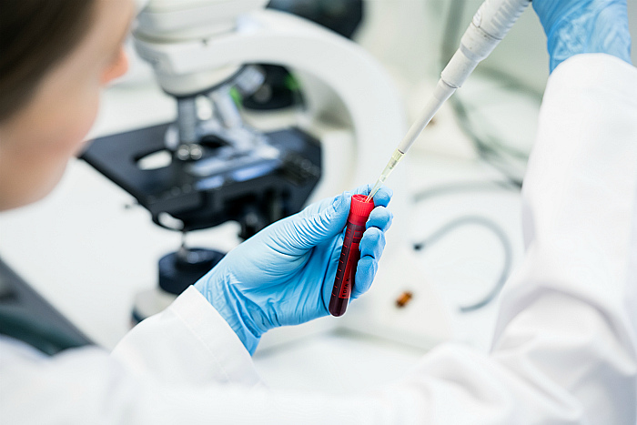 British company launches 20-second COVID-19 test