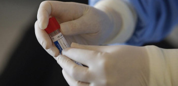 Azerbaijan confirms 108 new coronavirus cases