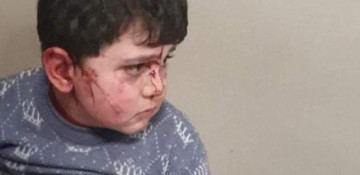 Education Ministry: 10 schoolchildren wounded after attack on Ganja