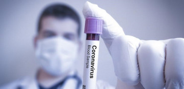 Azerbaijan confirms 2,735 new coronavirus cases