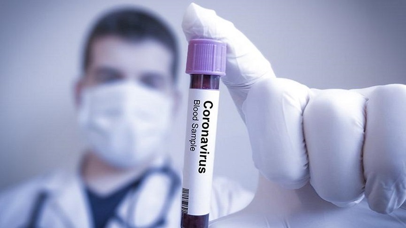 Azerbaijan sees rise in COVID-19 cases
