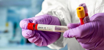 Azerbaijan reports 4,323 new COVID-19 cases