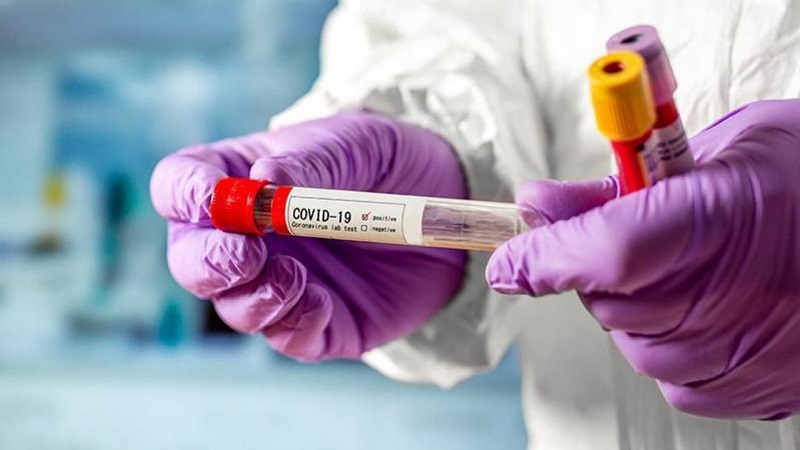 Azerbaijan’s coronavirus tests surpass 2 million