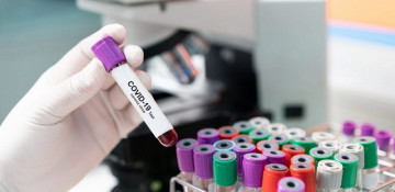 Azerbaijan`s daily COVID-19 recoveries more than infections