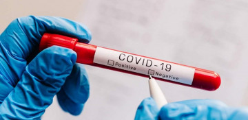 Azerbaijan sees rise in COVID-19 recoveries