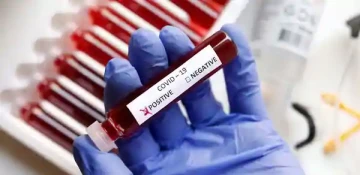 Zimbabwe: Coronavirus claims transport minister