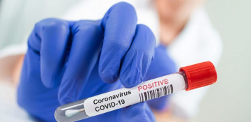Azerbaijan records 115 fresh coronavirus cases