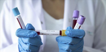 Azerbaijan reports 155 new coronavirus cases