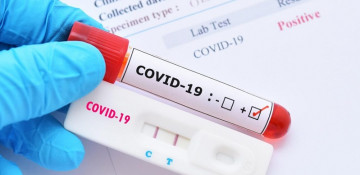 Azerbaijan confirms 278 new COVID-19 cases
