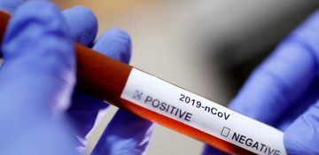 Azerbaijan confirms 353 new coronavirus cases