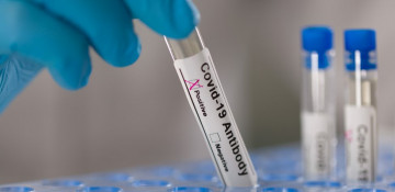 At least 20% of recovered patients do not develop COVID-19 antibodies, expert says