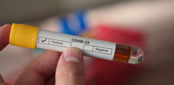 Azerbaijan sees surge in COVID-19 cases